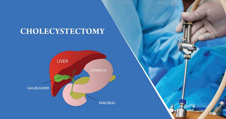 IMC Hospital Blog